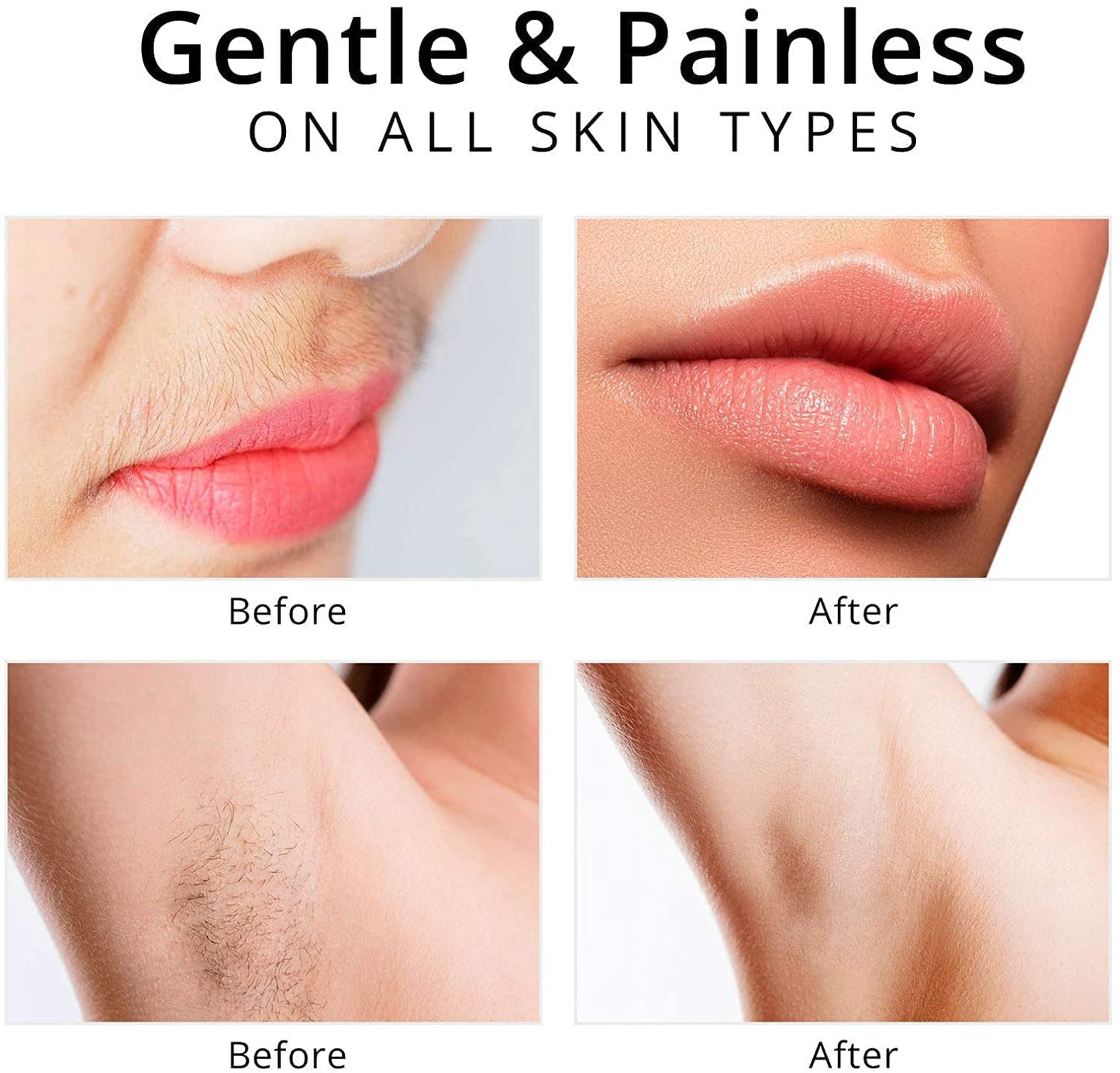 Facial Hair Remover